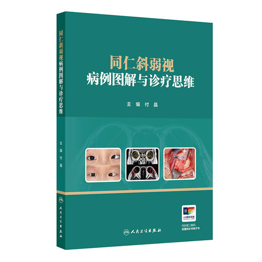 同仁斜弱视病例图解与诊疗思维 付晶 主编 共分为6章 依次围绕弱视 共同性内斜视 共同性外斜视及其他特殊病例展开 人民卫生出版社 商品图1