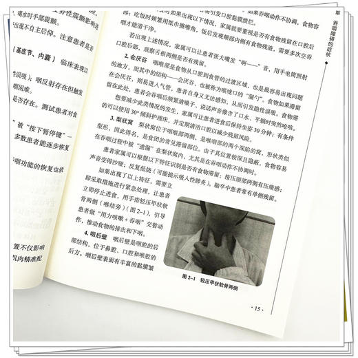 吞咽障碍家庭康复指导 潘江 石文英 李里 主编 中国中医药出版社 商品图3