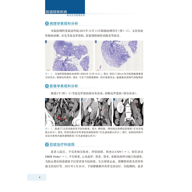 试读PDF-9787308273886(1-1)-肠道疑难疾病转诊会诊图谱百例_014.jpg
