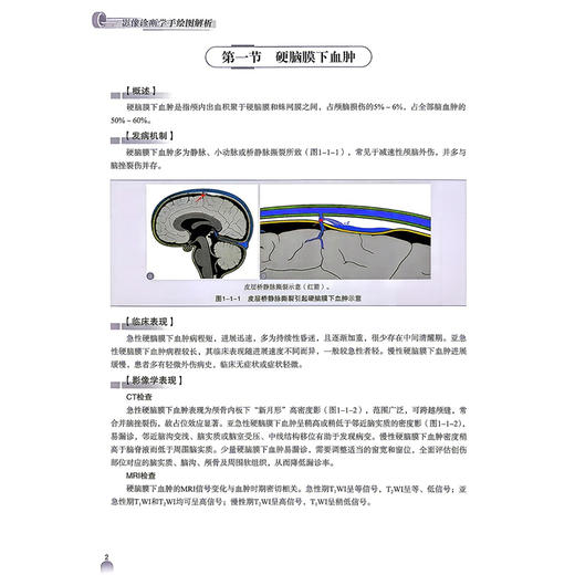 影像诊断学手绘图解析 罗晓东 韩志江 张景峰 主编 全书共有图像近2000幅 其中手绘图约970幅 9787523534793科学技术文献出版社 商品图4