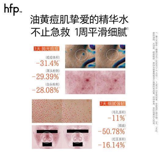 【正品直售】hfp™毛孔管理精华水 商品图3
