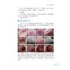 肠道疑难疾病转诊会诊图谱百例/沈骏、冯琦、贺薇/浙江大学出版社 商品缩略图3