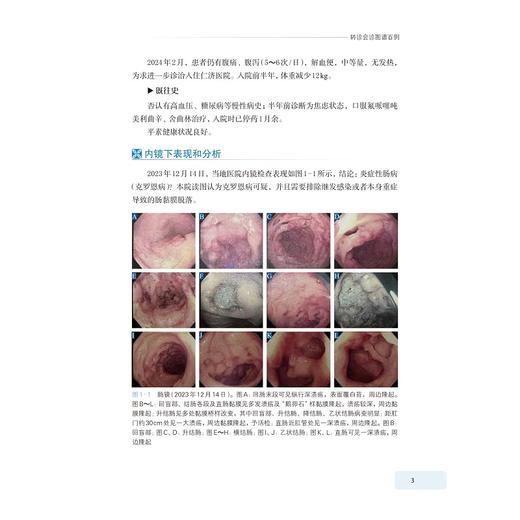 肠道疑难疾病转诊会诊图谱百例/沈骏、冯琦、贺薇/浙江大学出版社 商品图3