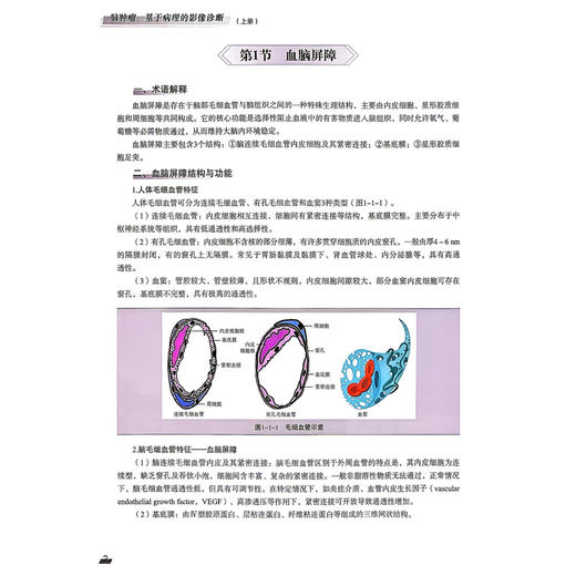 脑肿瘤 基于病理的影像诊断 上册 王宇军 等主编 医学影像联盟经典丛书 深入阐释了影像学表现的组织病理学基础科学技术文献出版社 商品图3