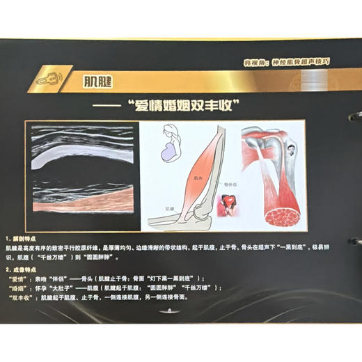 亮视角：神经肌骨超声技巧 何亮亮 赵文星 崔晓红 主编 49个讲解技巧的视频 以全新视角融合超声声像图等内容 科学技术文献出版社 商品图4