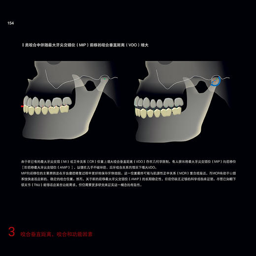 牙齿磨损控制与微创修复 周炜 主译 系统构建了牙齿磨损诊疗从评估诊断到修复维护的完整知识体系9787559145840辽宁科学技术出版社 商品图4