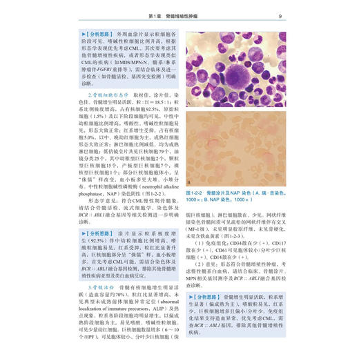 血液病MICM综合诊断——经典病例篇 郑磊 褚帅 陈炜烨 主编 细胞形态学 免疫学 细胞遗传学 分子生物学 9787030862471 科学出版社 商品图4
