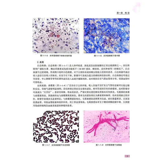 病毒性肺炎与鹦鹉热肺炎诊断及治疗 曾炳亮 范兵 胡志伟 主编 全书为肺部感染疾病的诊疗提供了全面系统的指导 科学技术文献出版社 商品图4