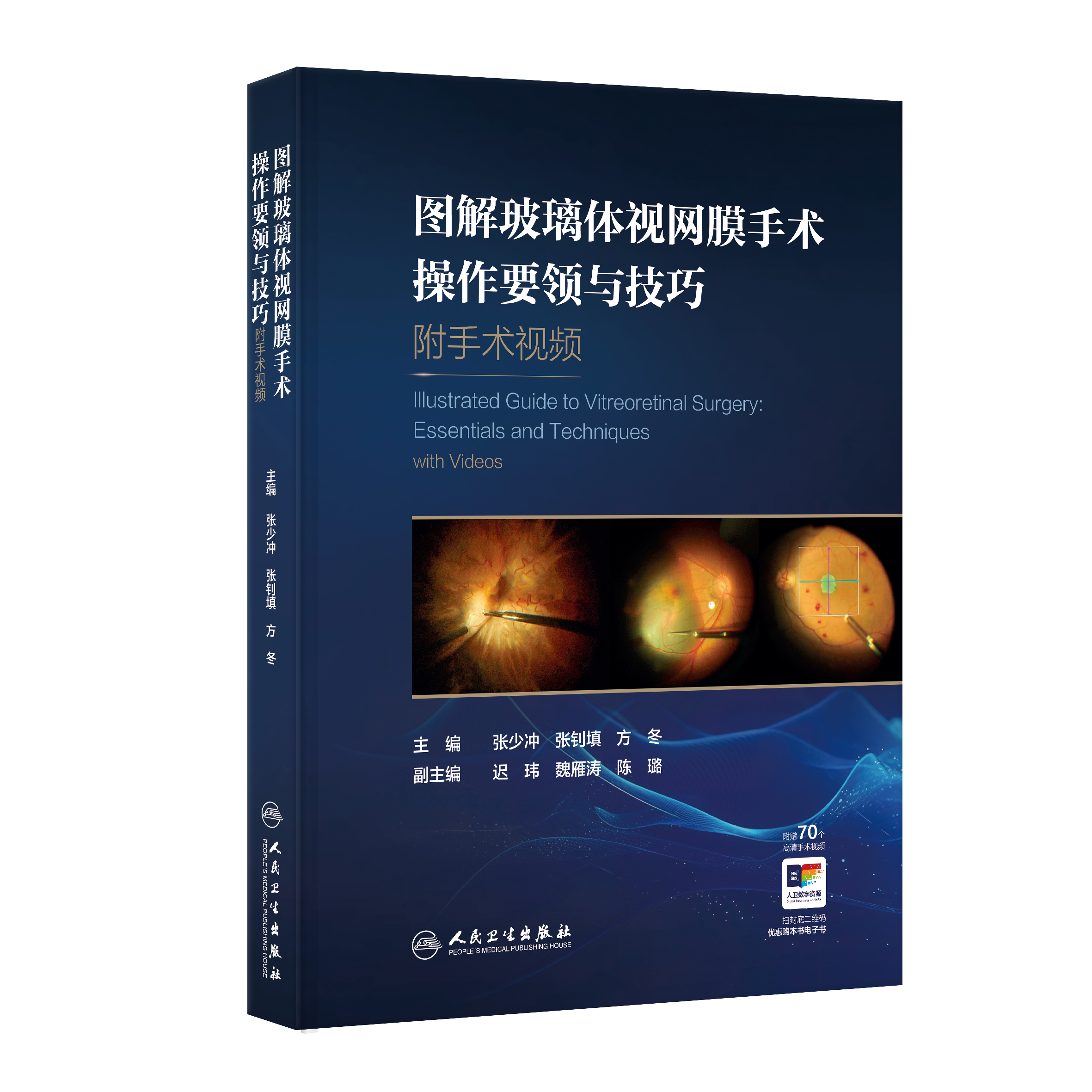 图解玻璃体视网膜手术操作要领与技巧