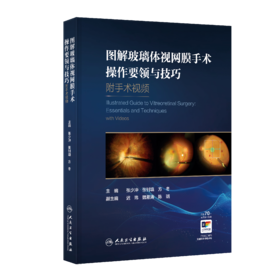 图解玻璃体视网膜手术操作要领与技巧