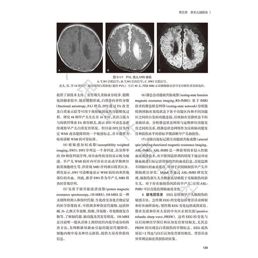 儿童神经修复学 陈光福 主编 可为从事儿童神经修复的相关医务人员提供基础理论、临床实践参考 9787117400404 人民卫生出版社 商品图4