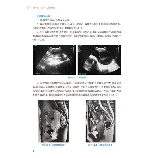 高原基层医生临床必读——北京市医疗“组团式”援藏经典病例 张宁 主编 汇总高原常见的内外妇儿各科疾病案例 人民卫生出版社 商品图4