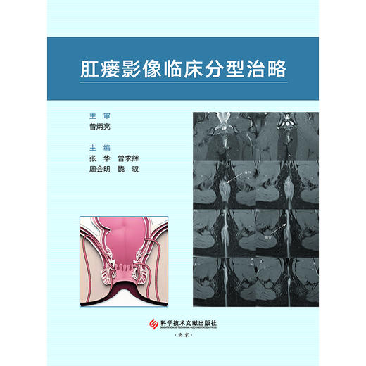 肛瘘影像临床分型治略 商品图2