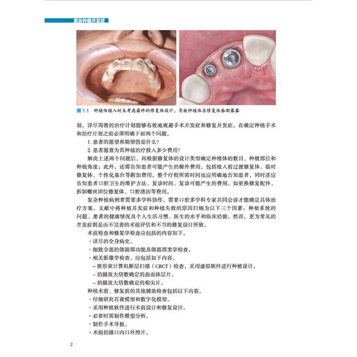 复杂种植并发症 商品图2