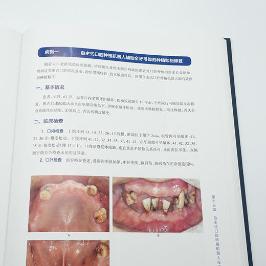 自主式口腔种植机器人 商品图3