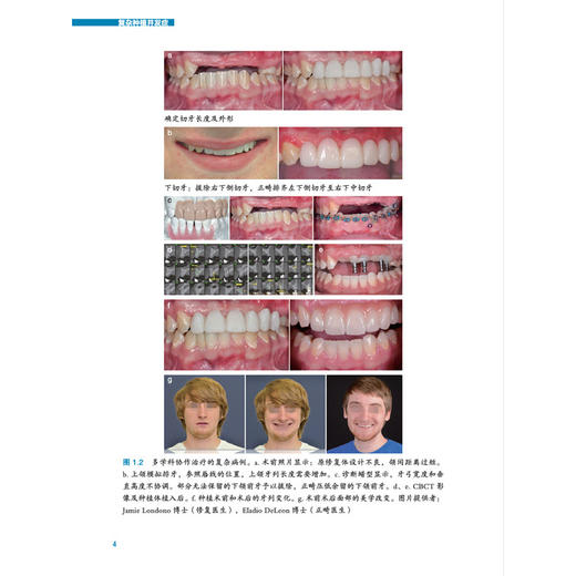 复杂种植并发症 商品图4