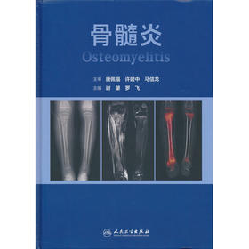 骨髓炎