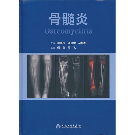 骨髓炎 商品图0