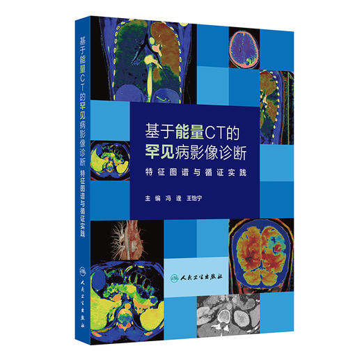 基于能量CT的罕见病影像诊断——特征图谱与循证实践 商品图0