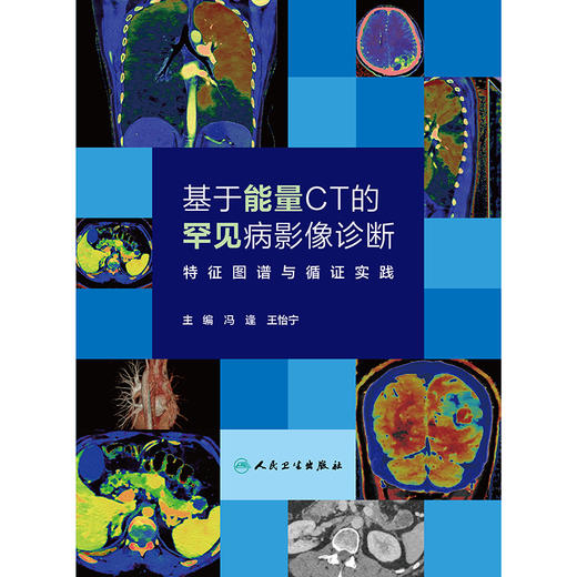 基于能量CT的罕见病影像诊断——特征图谱与循证实践 商品图1