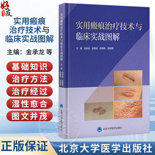 实用瘢痕治疗技术与临床实战图解 金承龙 金哲虎 陈晓栋 周炳荣 主编 系统介绍瘢痕基础知识 治疗方法 等内容 北京大学医学出版社 商品图0