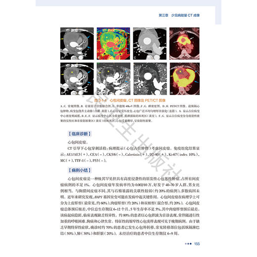 基于能量CT的罕见病影像诊断 特征图谱与循证实践 冯逢 王怡宁 本书是国内首部系统介绍罕见病CT能量成像诊断的专著人民卫生出版社 商品图4