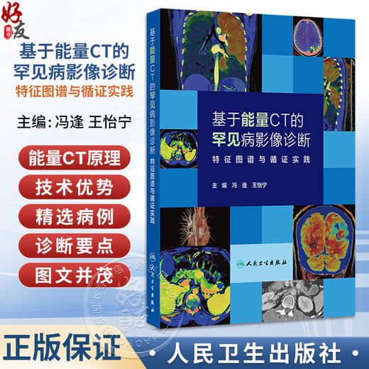 基于能量CT的罕见病影像诊断 特征图谱与循证实践 冯逢 王怡宁 本书是国内首部系统介绍罕见病CT能量成像诊断的专著人民卫生出版社 商品图0