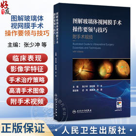 图解玻璃体视网膜手术操作要领与技巧 附手术视频 张少冲 张钊填 方冬 主编 参考书 眼科学 西医 9787117403016 人民卫生出版社