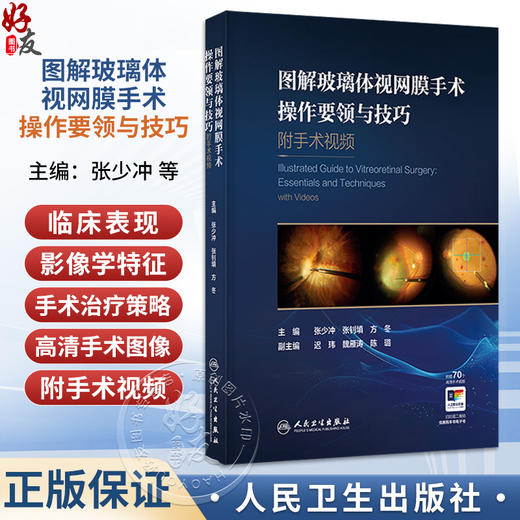 图解玻璃体视网膜手术操作要领与技巧 附手术视频 张少冲 张钊填 方冬 主编 参考书 眼科学 西医 9787117403016 人民卫生出版社 商品图0