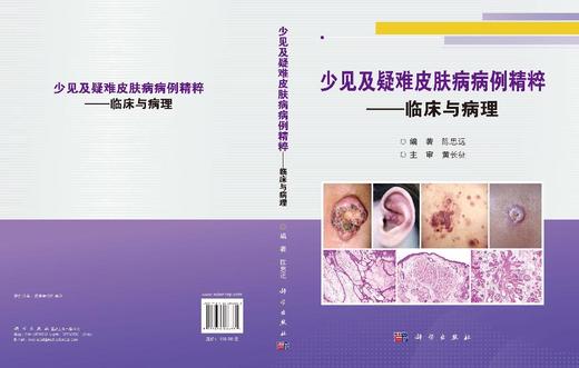 少见及疑难皮肤病病例精粹——临床与病理 陈思远 编 9787030866882 商品图3