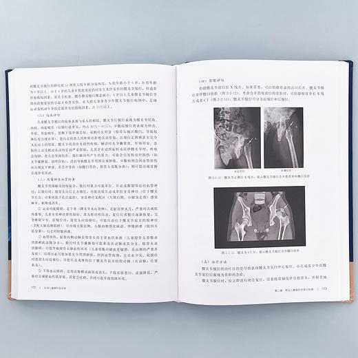实用儿童骨科急诊学 商品图4