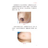 守护希望 乳腺癌与生育 李金花 欧阳取长 围绕乳腺癌生育康复 设计了72个问题 提供全面 科学 实用的生育信息与指导人民卫生出版社 商品缩略图4