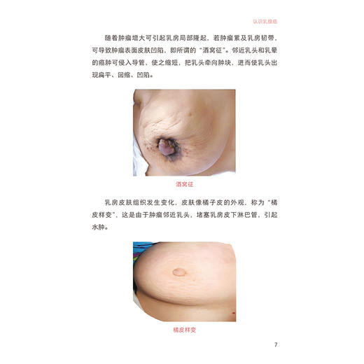 守护希望 乳腺癌与生育 李金花 欧阳取长 围绕乳腺癌生育康复 设计了72个问题 提供全面 科学 实用的生育信息与指导人民卫生出版社 商品图4