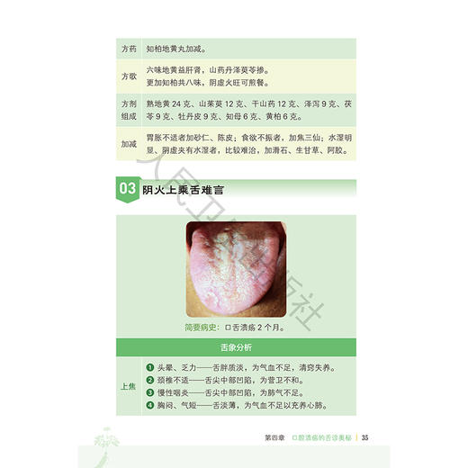 图解舌诊断病4 掀起脾胃盖头 来要良 来要水 主编 全书采用图表的形式 对典型病例的高清舌象图进行详细分析 人民卫生出版社 商品图4