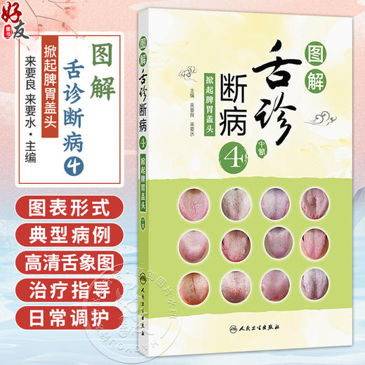 图解舌诊断病4 掀起脾胃盖头 来要良 来要水 主编 全书采用图表的形式 对典型病例的高清舌象图进行详细分析 人民卫生出版社 商品图0