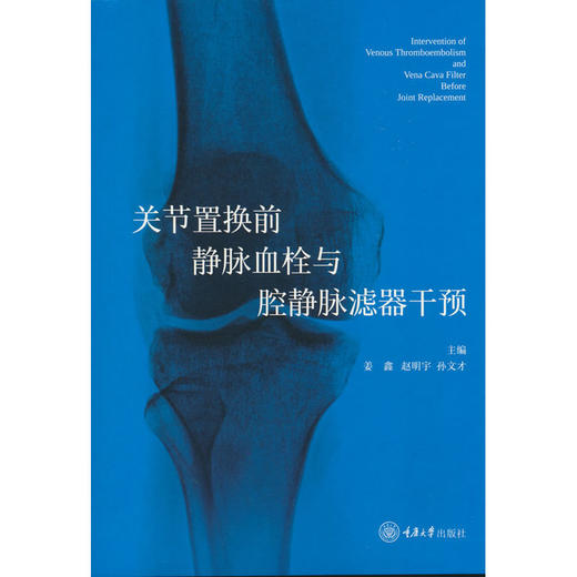 关节置换前静脉血栓与腔静脉滤器干预 商品图0