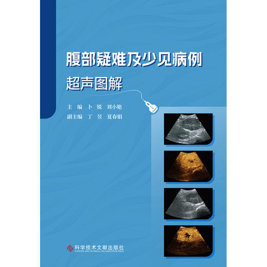 腹部疑难及少见病例超声图解 商品图0