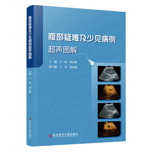 腹部疑难及少见病例超声图解 商品图1