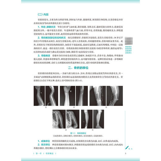 中医正骨学 第3三版 罗毅文 黄勇 本科中医药类 配增值 十五五规划教材 全国高等学校中医药教育教材 9787117398886人民卫生出版社 商品图4