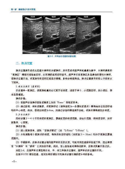 床旁超声——围术期应用 商品图12