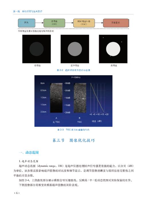 床旁超声——围术期应用 商品图10