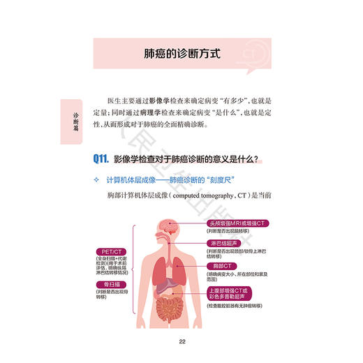 早中期肺癌患者教育手册 王俊 杨帆 全书围绕早中期肺癌诊疗全流程 详解患者教育要点与医患沟通技巧 内容科学 人民卫生出版社 商品图4