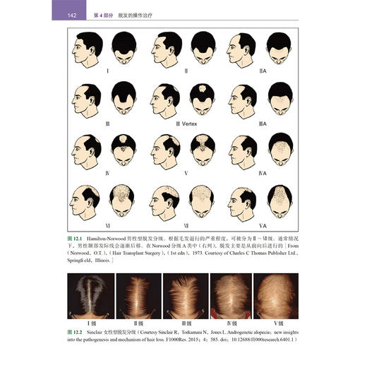 毛发修复 周城 主译 介绍了最新的毛发修复技术 重点关注弥漫性、非瘢痕性脱发（包括雄激素性秃发）等内容 北京大学医学出版社 商品图4
