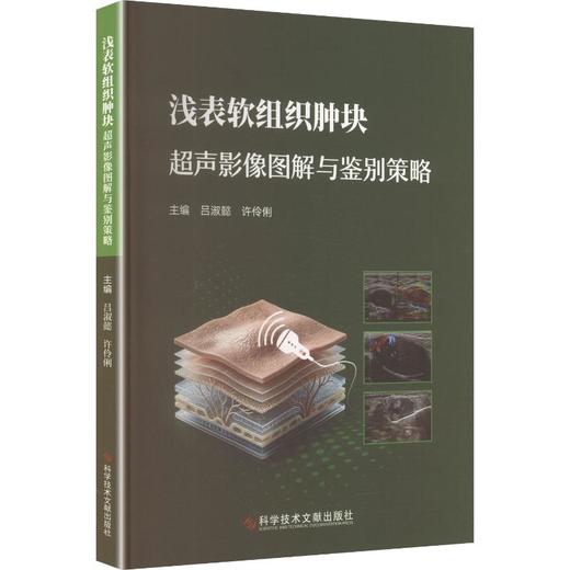浅表软组织肿块超声影像图解与鉴别策略 商品图0