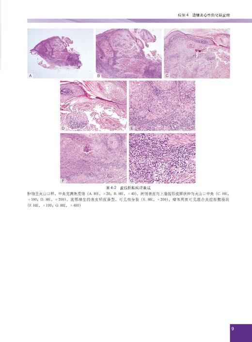 少见及疑难皮肤病病例精粹——临床与病理 陈思远 编 9787030866882 商品图12