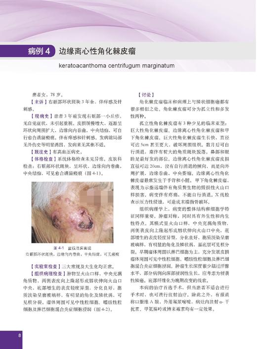 少见及疑难皮肤病病例精粹——临床与病理 陈思远 编 9787030866882 商品图11