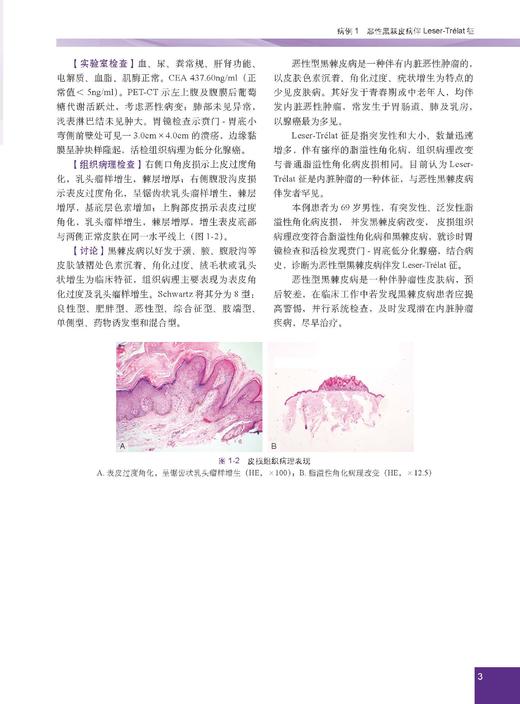 少见及疑难皮肤病病例精粹——临床与病理 陈思远 编 9787030866882 商品图6