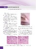 少见及疑难皮肤病病例精粹——临床与病理 陈思远 编 9787030866882 商品缩略图9