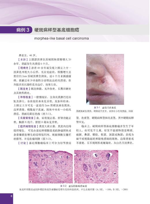 少见及疑难皮肤病病例精粹——临床与病理 陈思远 编 9787030866882 商品图9
