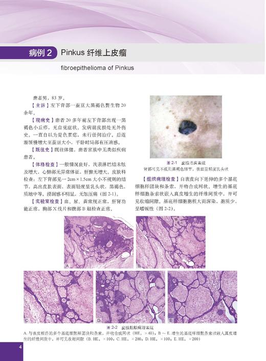 少见及疑难皮肤病病例精粹——临床与病理 陈思远 编 9787030866882 商品图7